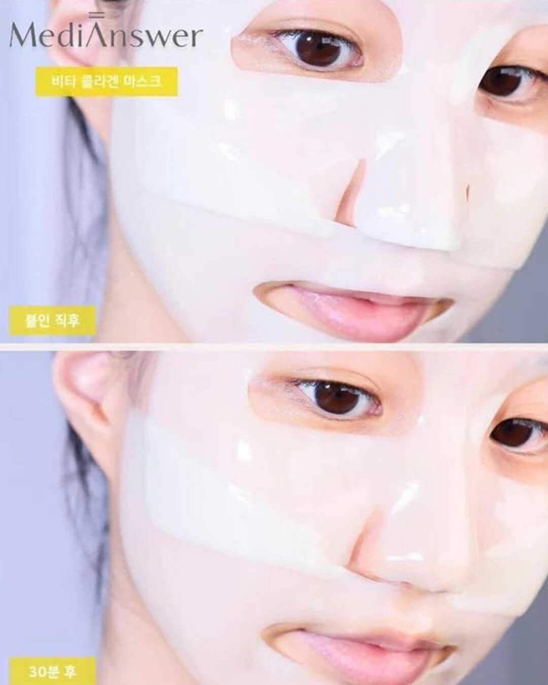 MediAnswer Vita Collagen Mask