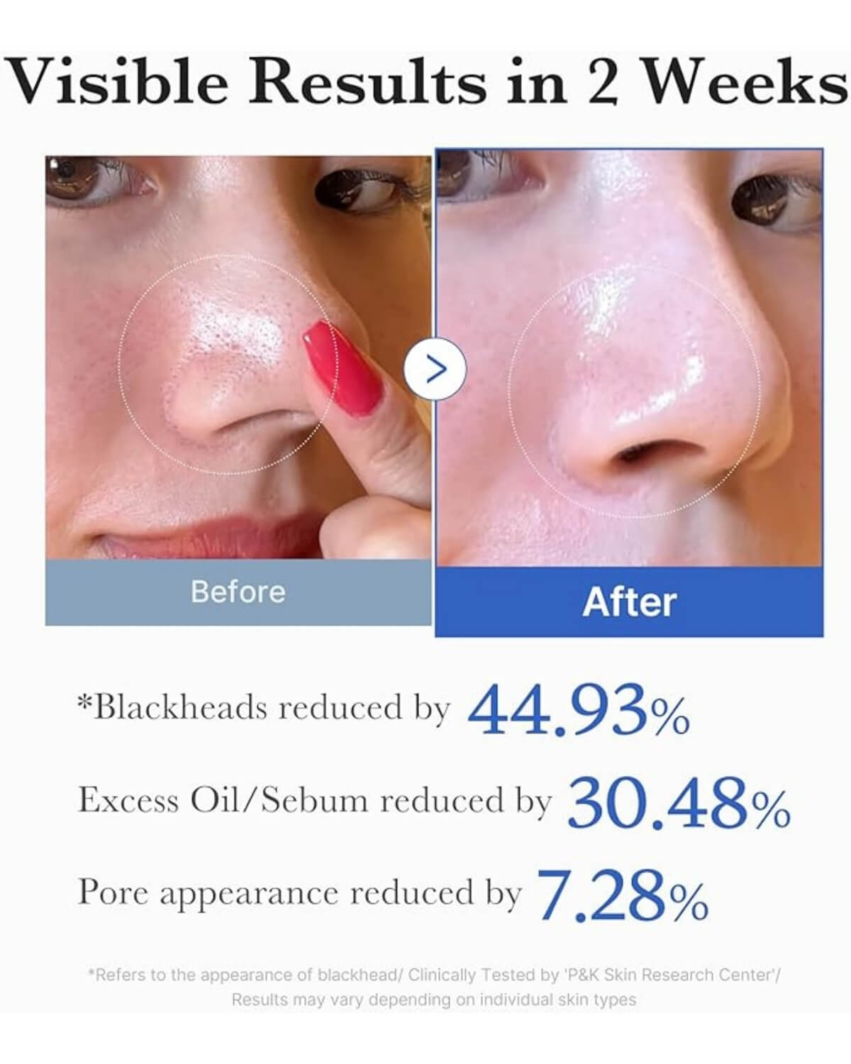 Medicube Zero Pore Pad 2.0